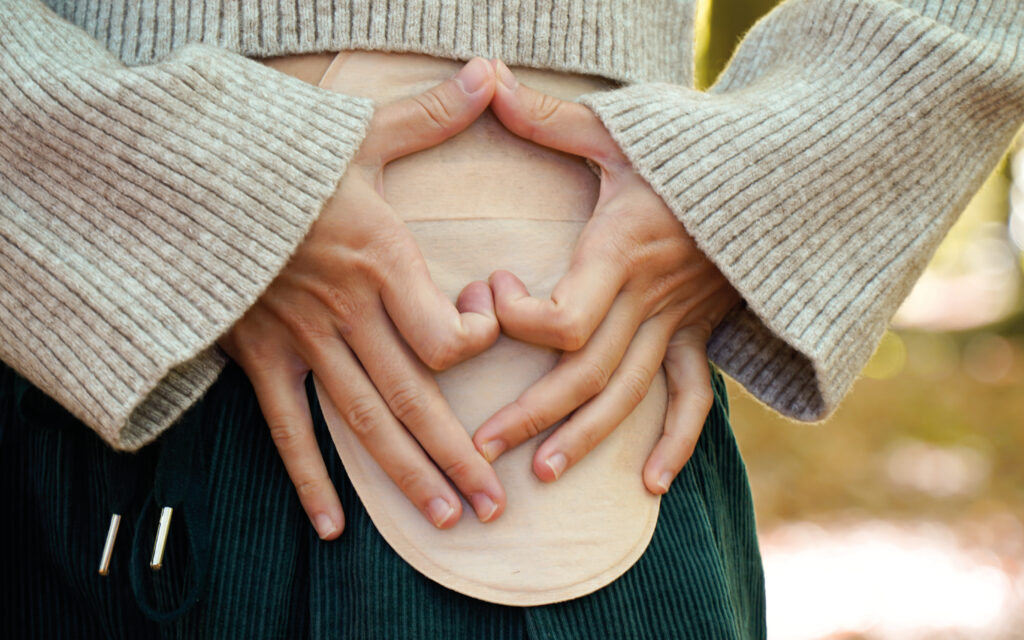 Stomapatiënten. Geuren. Geurbeheersing.
